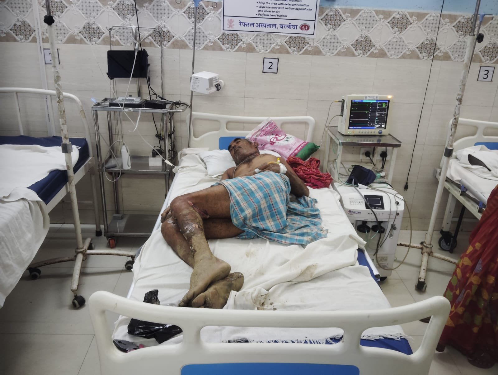 11 हजार वोल्ट लाइन की चपेट में आया बिजली मिस्त्री